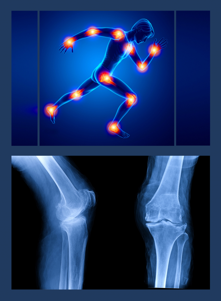 02ultraschall-röntgen-zusammen